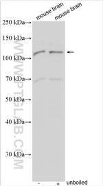 PCDH8 Antibody in Western Blot (WB)