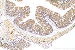 RARB Antibody in Immunohistochemistry (Paraffin) (IHC (P))