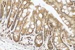 RARB Antibody in Immunohistochemistry (Paraffin) (IHC (P))