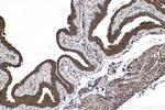 RARB Antibody in Immunohistochemistry (Paraffin) (IHC (P))
