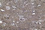 RARB Antibody in Immunohistochemistry (Paraffin) (IHC (P))