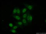 NFKBIZ Antibody in Immunocytochemistry (ICC/IF)