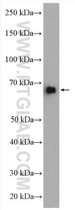 NFKBIZ Antibody in Western Blot (WB)