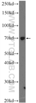 NFKBIZ Antibody in Western Blot (WB)