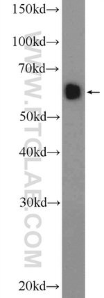 NFKBIZ Antibody in Western Blot (WB)