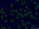 STAG1 Antibody in Immunocytochemistry (ICC/IF)