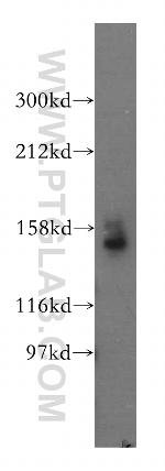 STAG1 Antibody in Western Blot (WB)