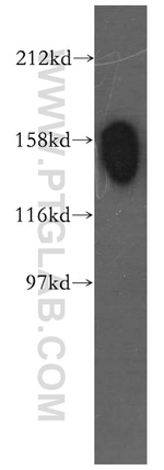 STAG1 Antibody in Western Blot (WB)
