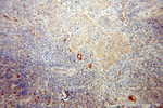 BACH1 Antibody in Immunohistochemistry (Paraffin) (IHC (P))