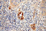 BACH1 Antibody in Immunohistochemistry (Paraffin) (IHC (P))