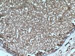 BACH1 Antibody in Immunohistochemistry (Paraffin) (IHC (P))