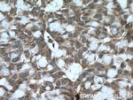 BACH1 Antibody in Immunohistochemistry (Paraffin) (IHC (P))