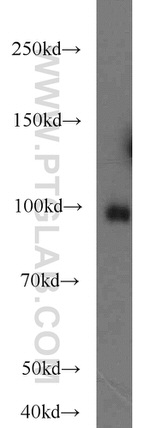 BACH1 Antibody in Western Blot (WB)