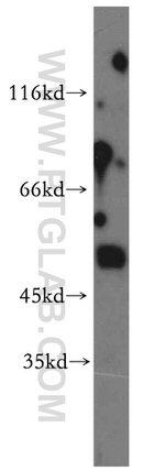 AADACL1 Antibody in Western Blot (WB)