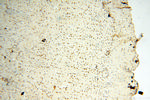 AADACL1 Antibody in Immunohistochemistry (Paraffin) (IHC (P))
