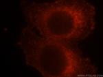 SOCS3 Antibody in Immunocytochemistry (ICC/IF)