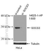 SOCS3 Antibody in Western Blot (WB)