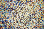 ROD1 Antibody in Immunohistochemistry (Paraffin) (IHC (P))