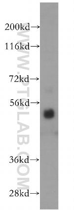 ROD1 Antibody in Western Blot (WB)