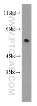 ROD1 Antibody in Western Blot (WB)