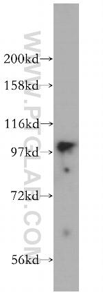 MYO1D Antibody in Western Blot (WB)