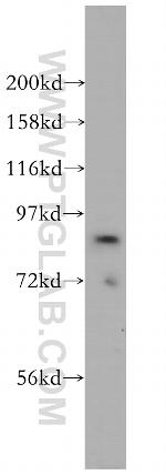 ACAP2 Antibody in Western Blot (WB)