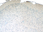 FEM1C Antibody in Immunohistochemistry (Paraffin) (IHC (P))