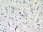 FEM1C Antibody in Immunohistochemistry (Paraffin) (IHC (P))