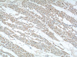 FEM1C Antibody in Immunohistochemistry (Paraffin) (IHC (P))
