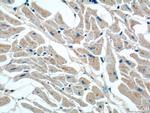 FEM1C Antibody in Immunohistochemistry (Paraffin) (IHC (P))