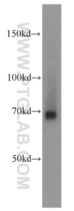 FEM1C Antibody in Western Blot (WB)