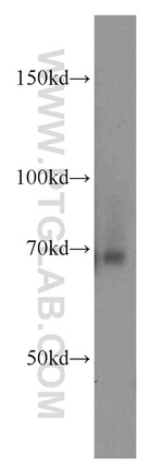 FEM1C Antibody in Western Blot (WB)