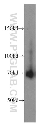 FEM1C Antibody in Western Blot (WB)