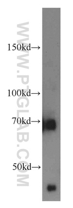 FEM1C Antibody in Western Blot (WB)