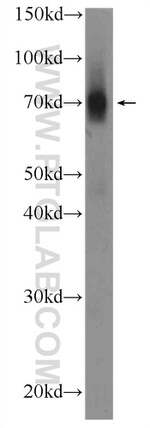 FEM1C Antibody in Western Blot (WB)