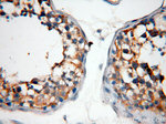ABHD2 Antibody in Immunohistochemistry (Paraffin) (IHC (P))