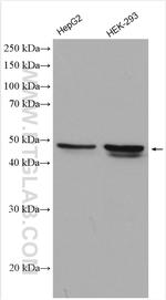 ABHD2 Antibody in Western Blot (WB)