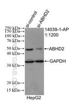 ABHD2 Antibody in Western Blot (WB)