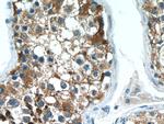 ACRV1 Antibody in Immunohistochemistry (Paraffin) (IHC (P))