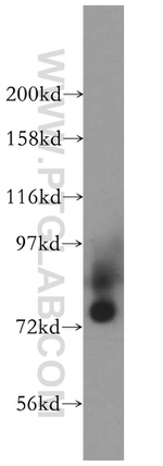HLCS Antibody in Western Blot (WB)