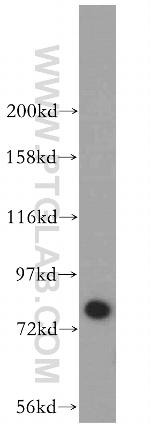 HLCS Antibody in Western Blot (WB)
