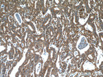CDK6 Antibody in Immunohistochemistry (Paraffin) (IHC (P))