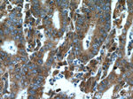 CDK6 Antibody in Immunohistochemistry (Paraffin) (IHC (P))