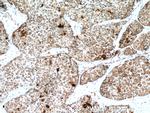 CDK6 Antibody in Immunohistochemistry (Paraffin) (IHC (P))