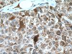 CDK6 Antibody in Immunohistochemistry (Paraffin) (IHC (P))