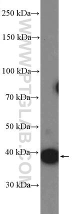 CDK6 Antibody in Western Blot (WB)