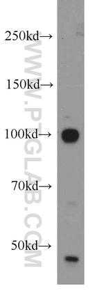 USP16 Antibody in Western Blot (WB)