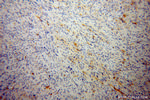 RGS7 Antibody in Immunohistochemistry (Paraffin) (IHC (P))