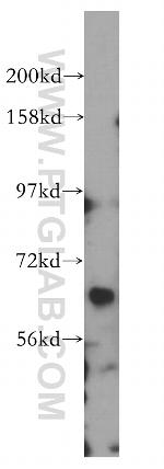 RGS7 Antibody in Western Blot (WB)