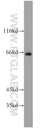 RGS7 Antibody in Western Blot (WB)